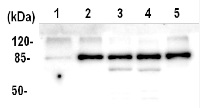 ATPase AAA2 domain in the group Antibodies for Plant/Algal / Environmental Stress / Heat shock at Agrisera AB (Antibodies for research) (AS11 1754)